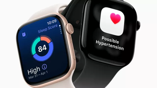 Apple Watch Series 11 à 379 € sur Cdiscount : 90 € de moins sur la 42 mm Cellular